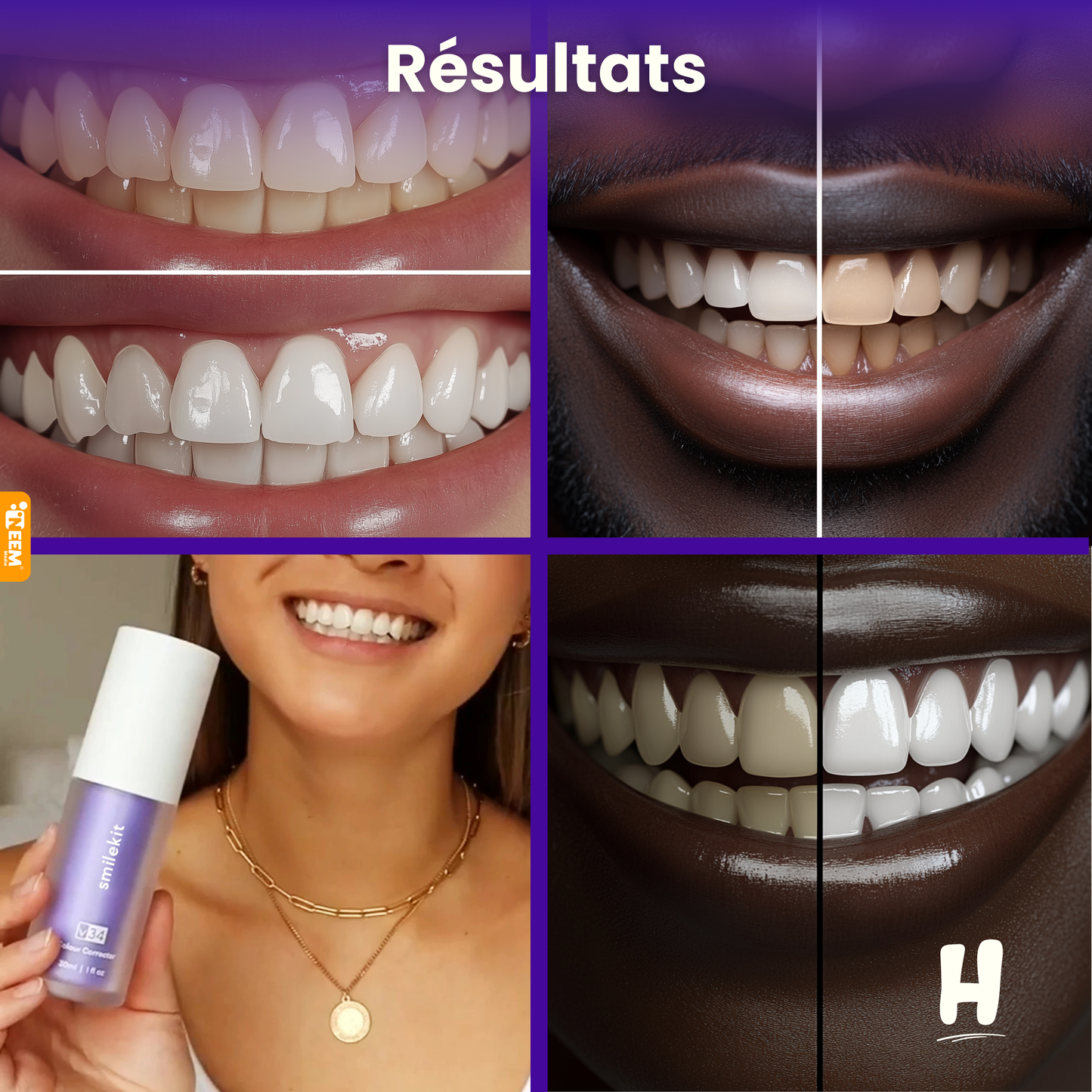 Dentifrice blanchiment dentaire (GAB)